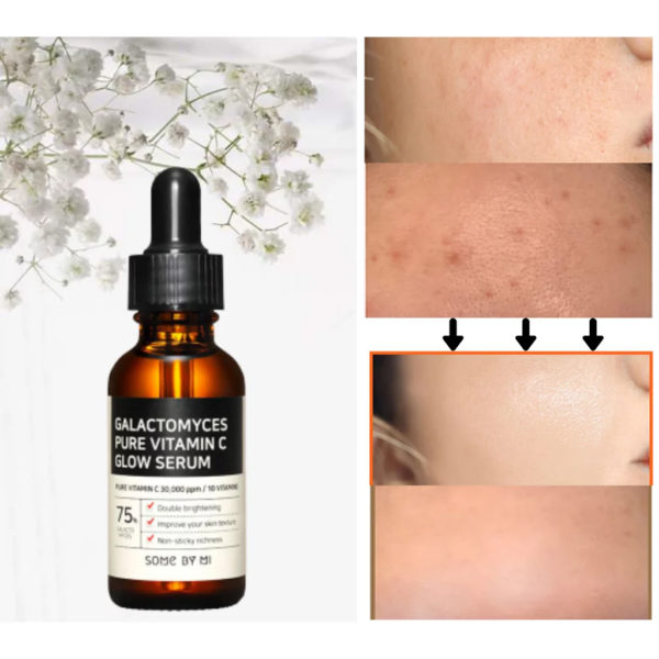 Some By Mi Galactomyces Pure Vitamin C Glow Serum - Image 6